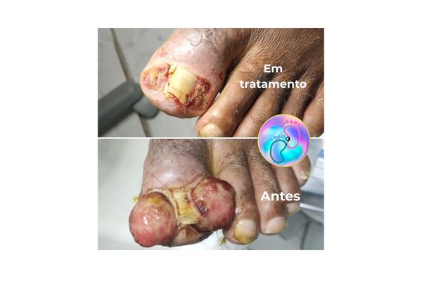 antes e depois 23